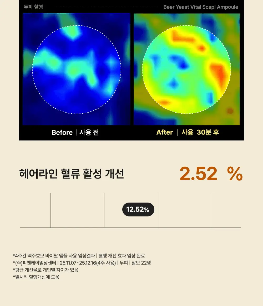 [5종임상완료/4주탈모케어] 애쉬로렌 맥주효모 바이탈 스칼프 앰플 100ml 상세페이지 29